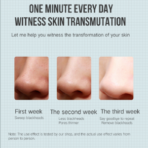 Electric Extractor Acne Removal Blackhead Remover Vacuüm Schoonheid Machine Pore Cleaner